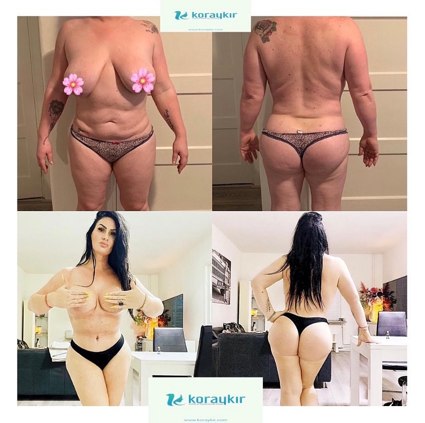 before-after