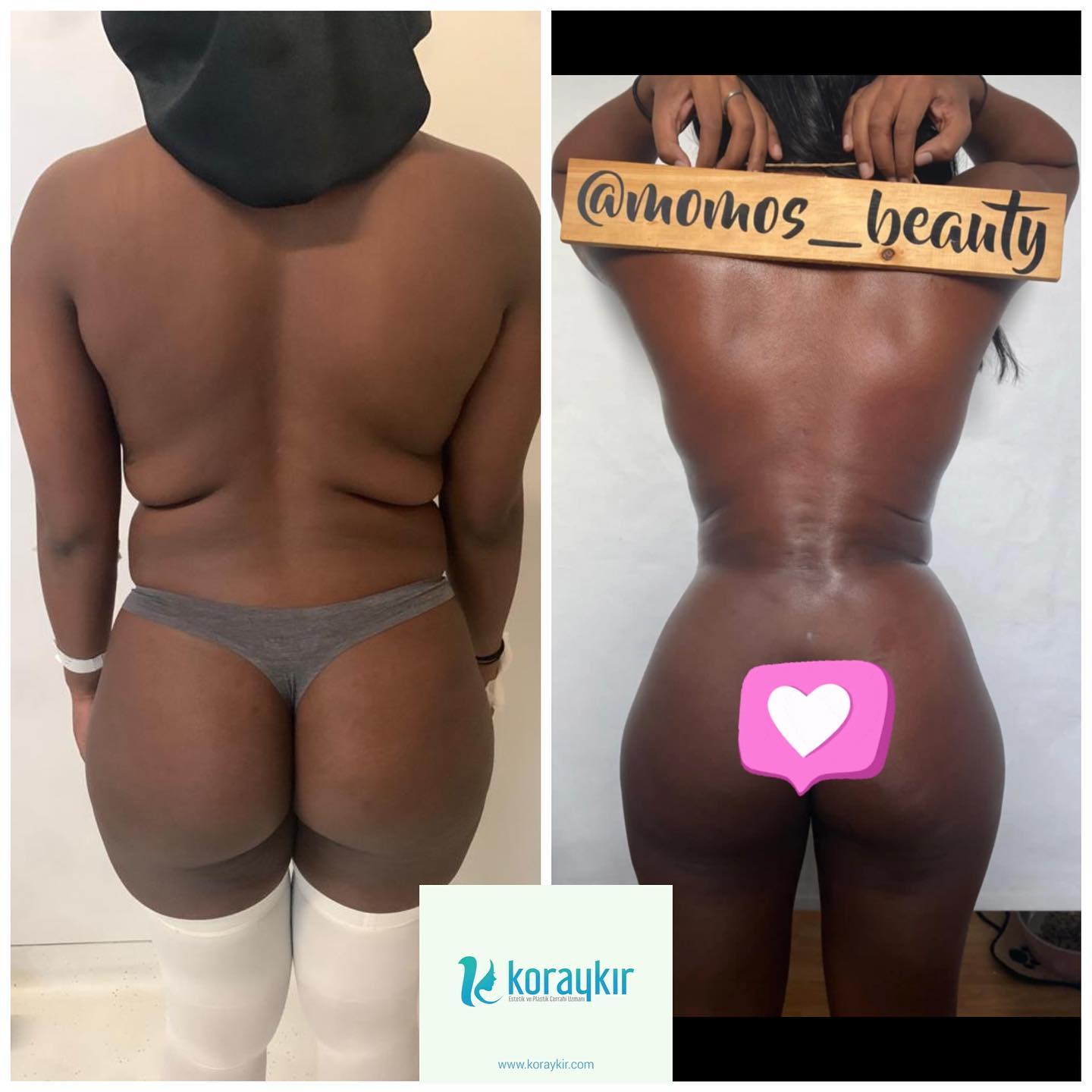 before-after