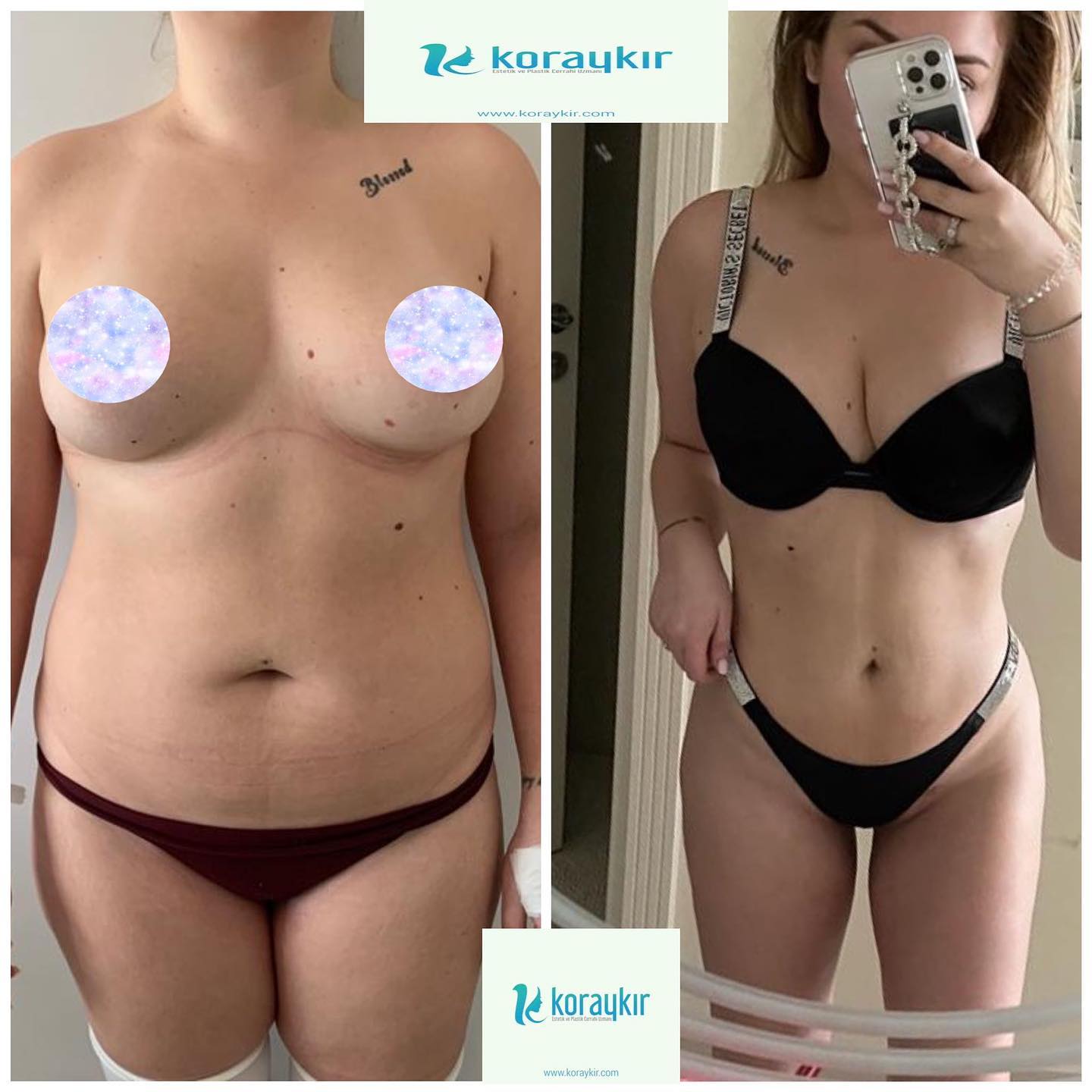 before-after
