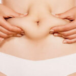 sigara ve liposuction iliskisi